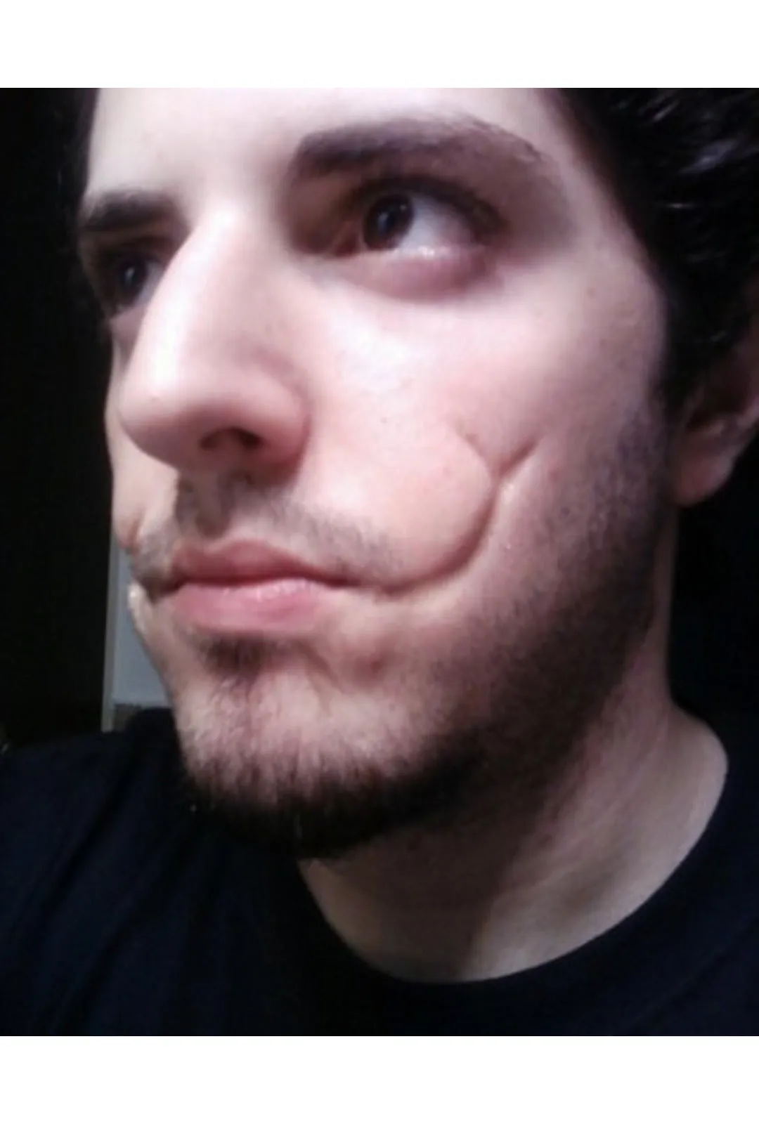 Rigid Collodion 15ML